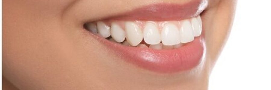Bright white smile after professional teeth whitening treatment