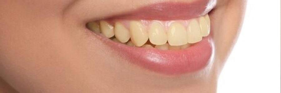 Close-up of stained and yellowed teeth before dental treatment